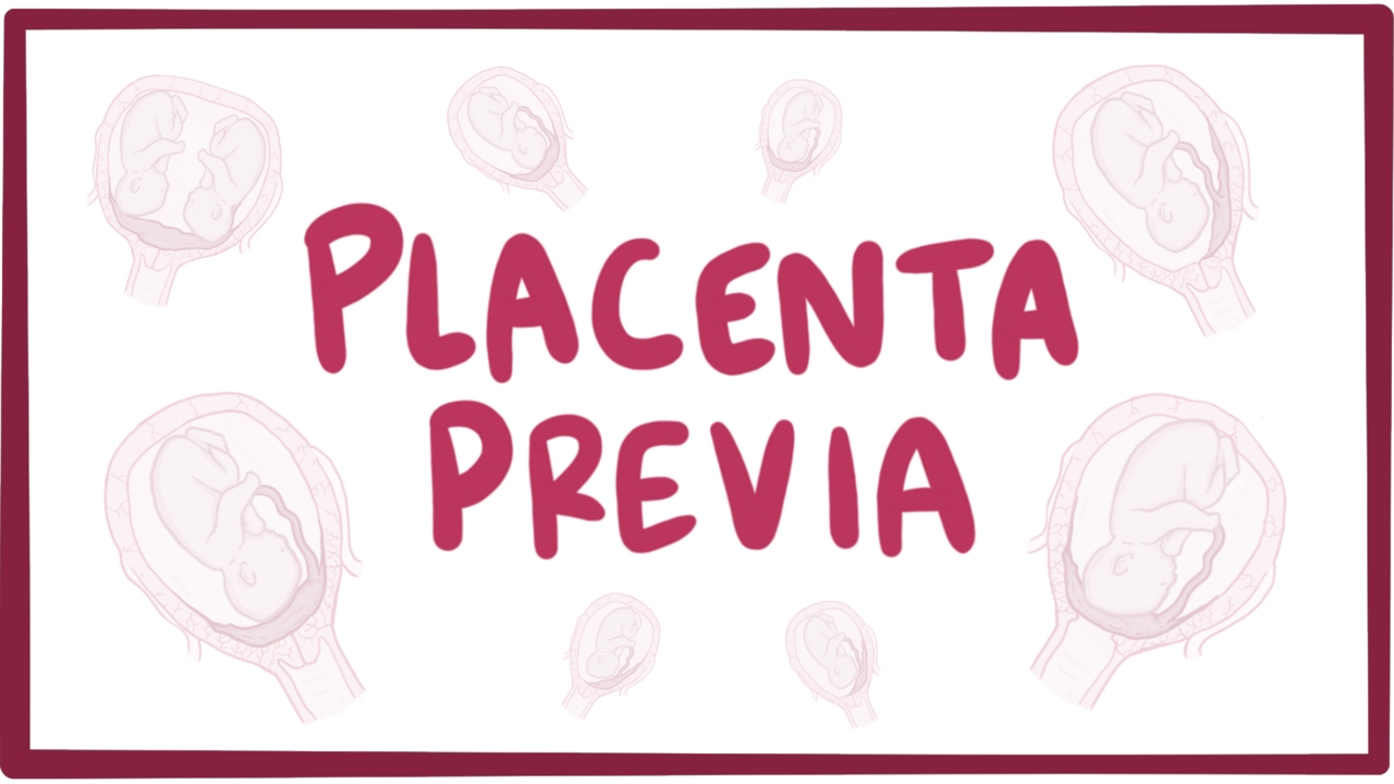 Placental Problems During Pregnancy And Management - HealthPally.com